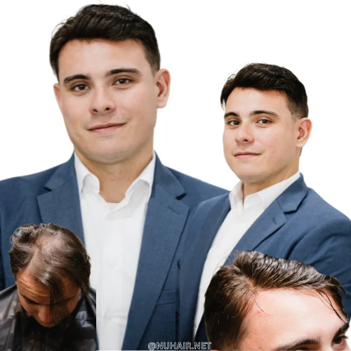 Jorge — hair restoration result, Nu Hair of Texas