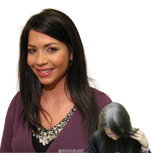Julie — hair restoration result, Nu Hair of Texas