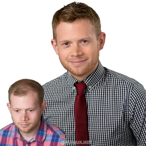 Men hair Replacement System New Hairstyle Dallas, TX