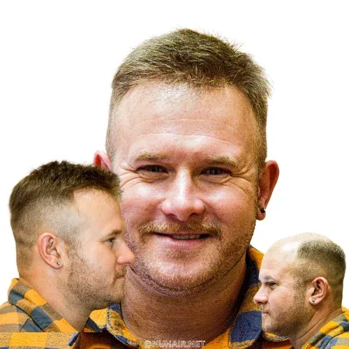 Men's Hair Replacement Hair Restoration DFW, Dallas